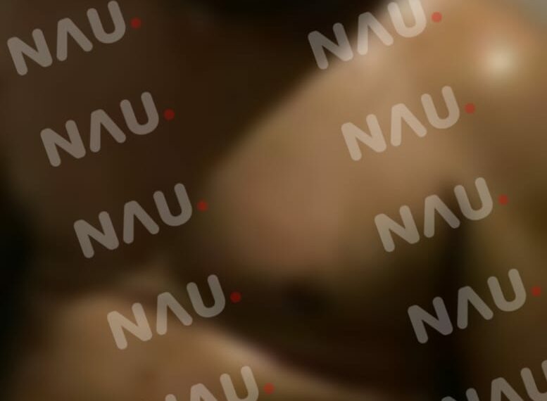 Policía de Huehuetán fue lesionado por un sujeto