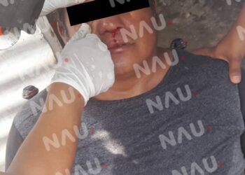 En riña golpean a una persona en el ejido Pacayalito