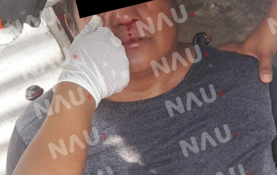 En riña golpean a una persona en el ejido Pacayalito