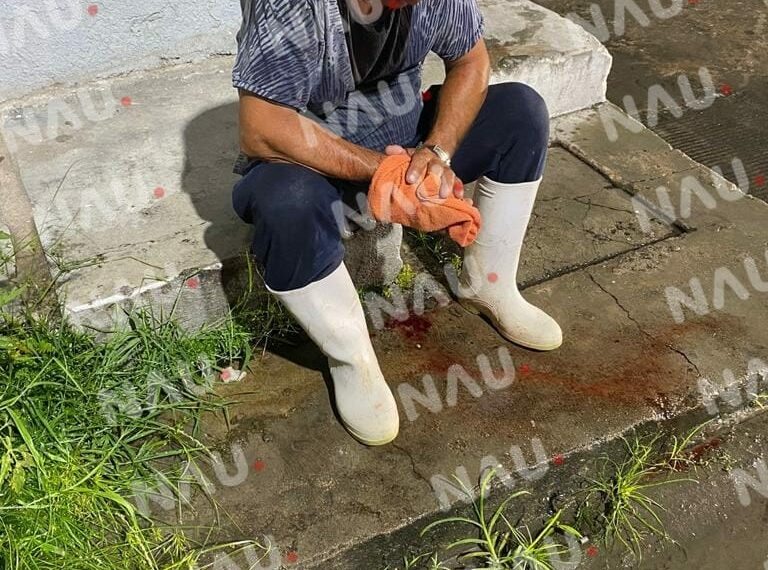 Cayó de su propia altura y fue atendido por PC de MAPASTEPEC