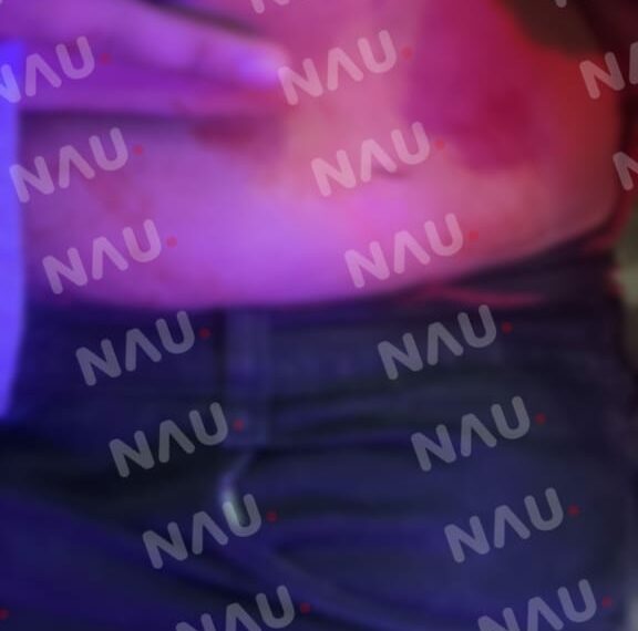 En asalto, hieren a un joven de 17 años en el centro de Tapachula