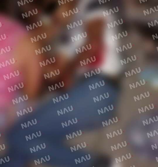 Menor resultó lesionado al accidentarse en una motocicleta.