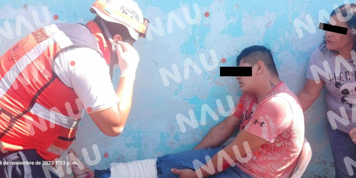 Derrapó en su motocicleta