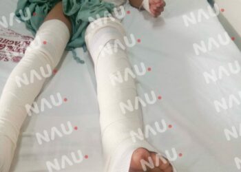 ¡Solicitamos tu apoyo para el niño Aníbal Velázquez !