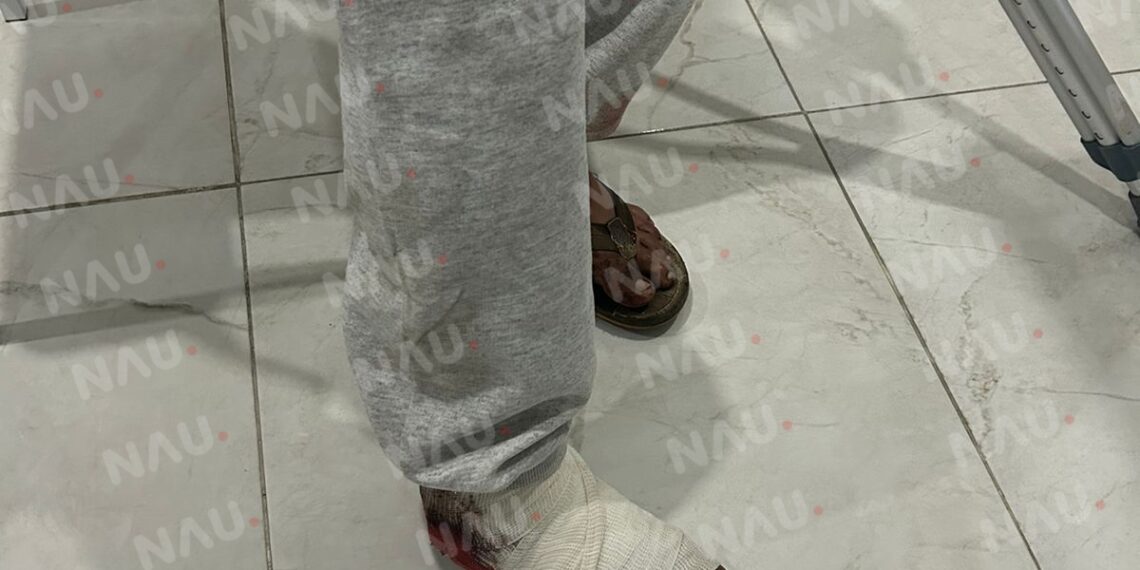 Presuntos elementos castrenses disparan en el pie a campesino en Tapachula, Chiapas