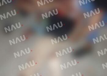 En asalto lesionan a machetazos a un salvadoreño