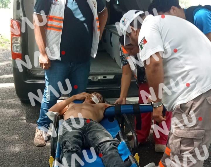 Accidente de Motocicleta en la Carretera Mapastepec Deja a un Joven con Fractura