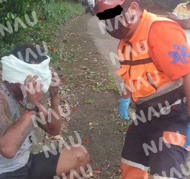 Accidente en motocicleta deja a dos heridos en Tapachula, Chiapas