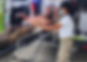 Trabajador sobrevive tras clavarse un machete en el pecho por accidente en Tapachula