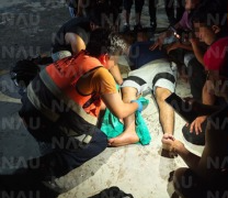 Joven se fractura jugando futbol