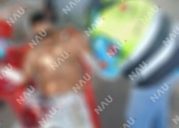 Hombre resulta lesionado por arma blanca mientras podaba un árbol en Tapachula