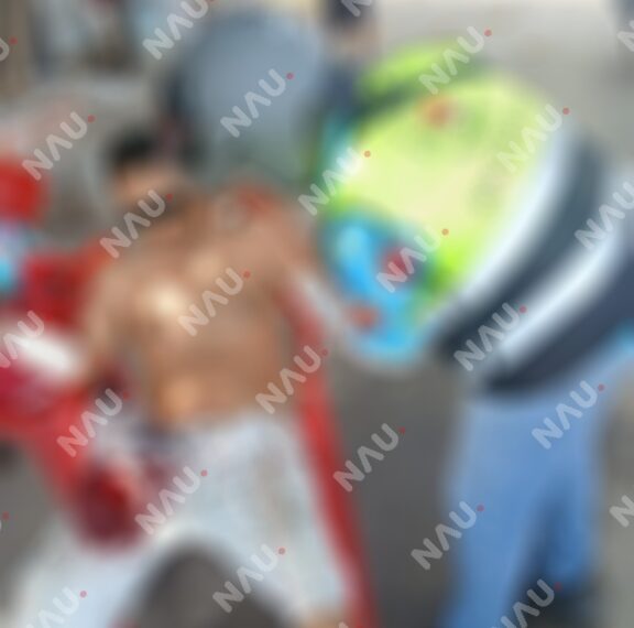 Hombre resulta lesionado por arma blanca mientras podaba un árbol en Tapachula