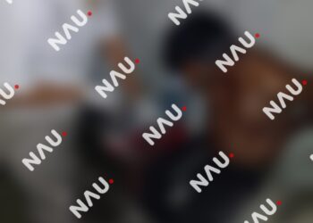 Sus propios hijos casi le quitan la vida a batazos en Mapastepec