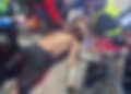 Delincuentes atacan a hondureño para quitarle su bicicleta en el sur de Tapachula