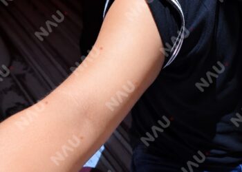 Detienen a presunto agresor por tentativa de feminicidio tras brutal golpiza a una mujer en Tapachula